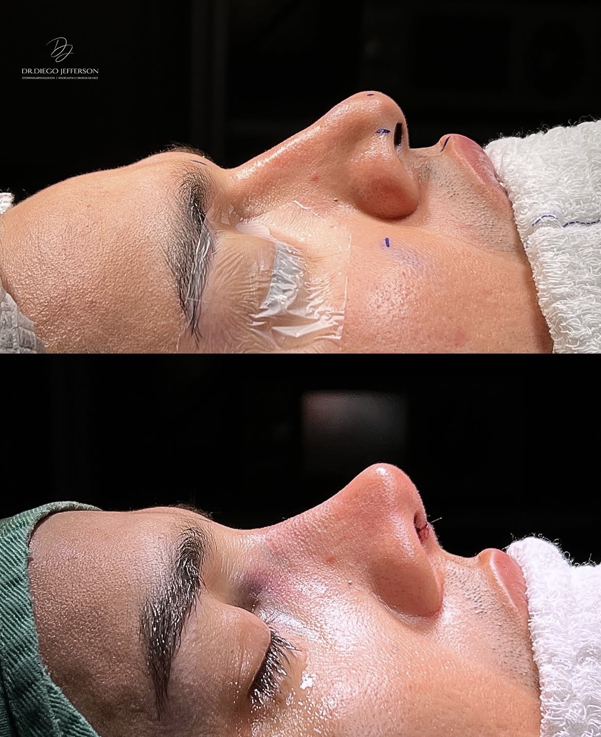 Comparativo antes e depois — caso clínico