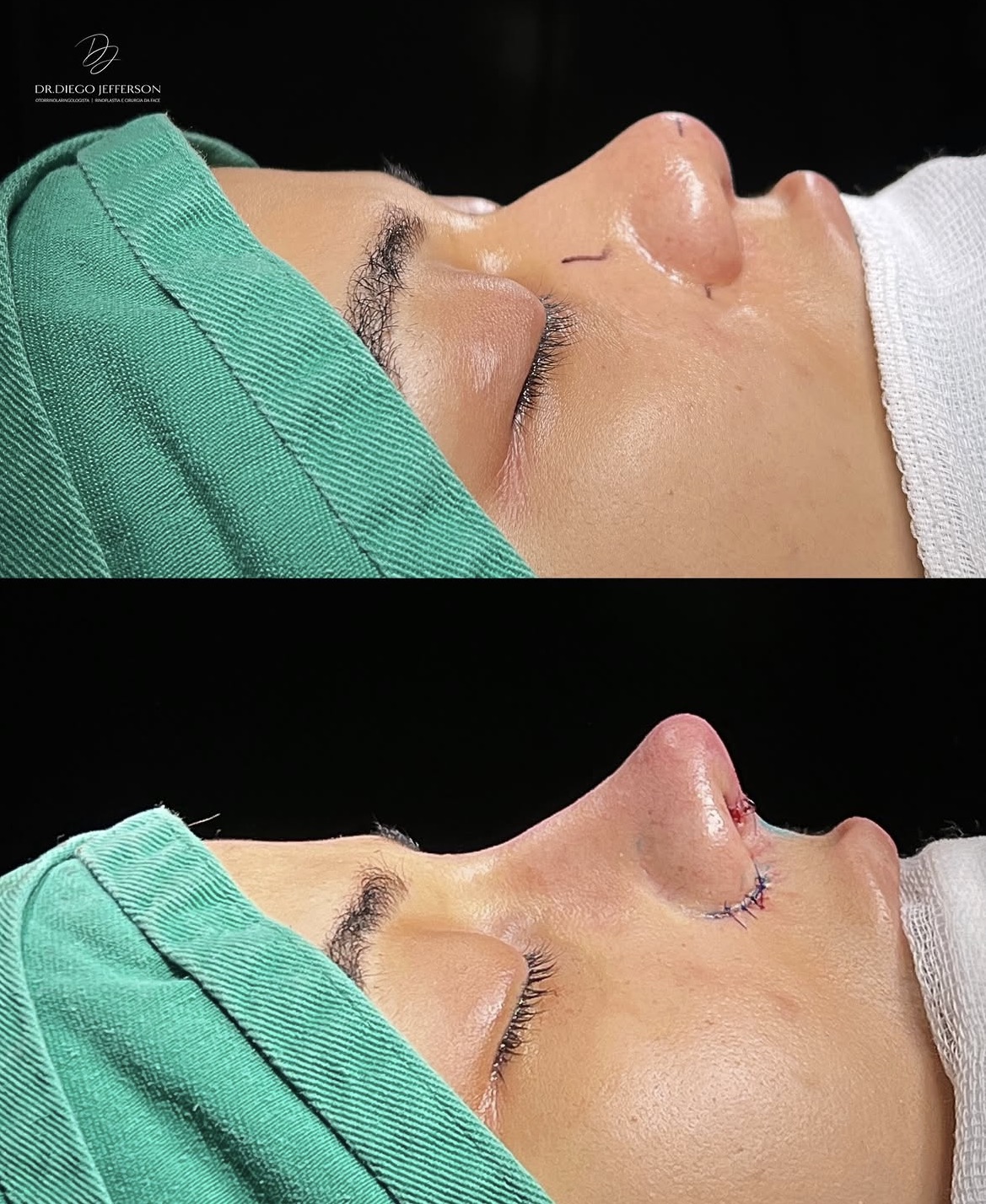 Comparativo antes e depois — caso clínico