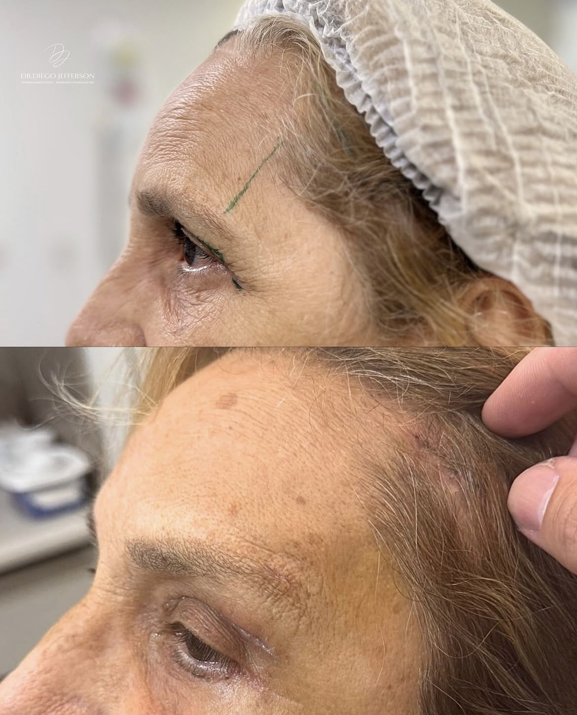 Comparativo antes e depois — caso clínico