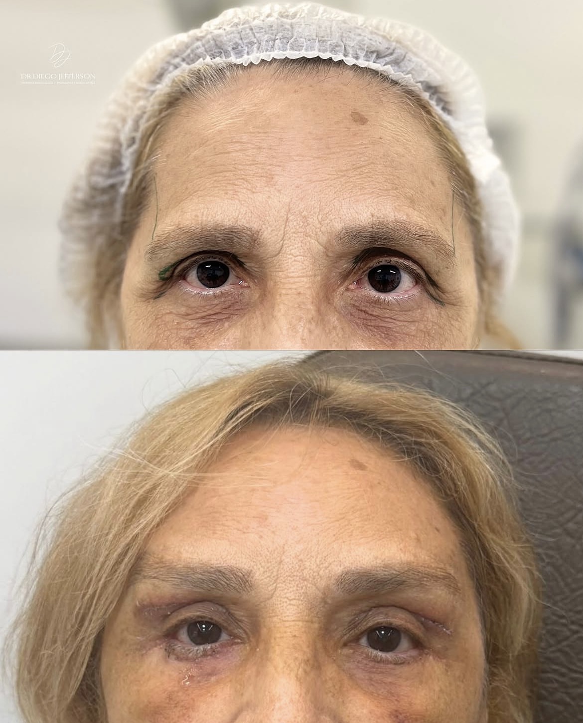 Comparativo antes e depois — caso clínico