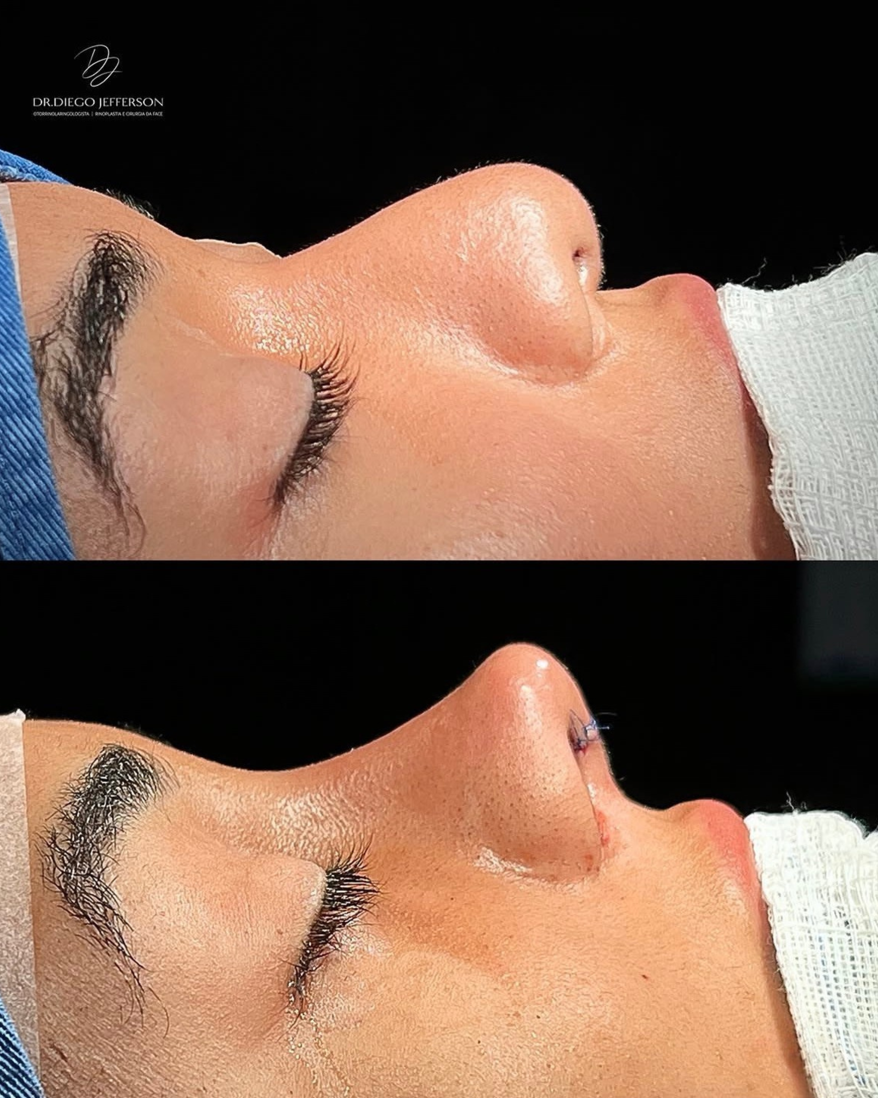 Comparativo antes e depois — caso clínico