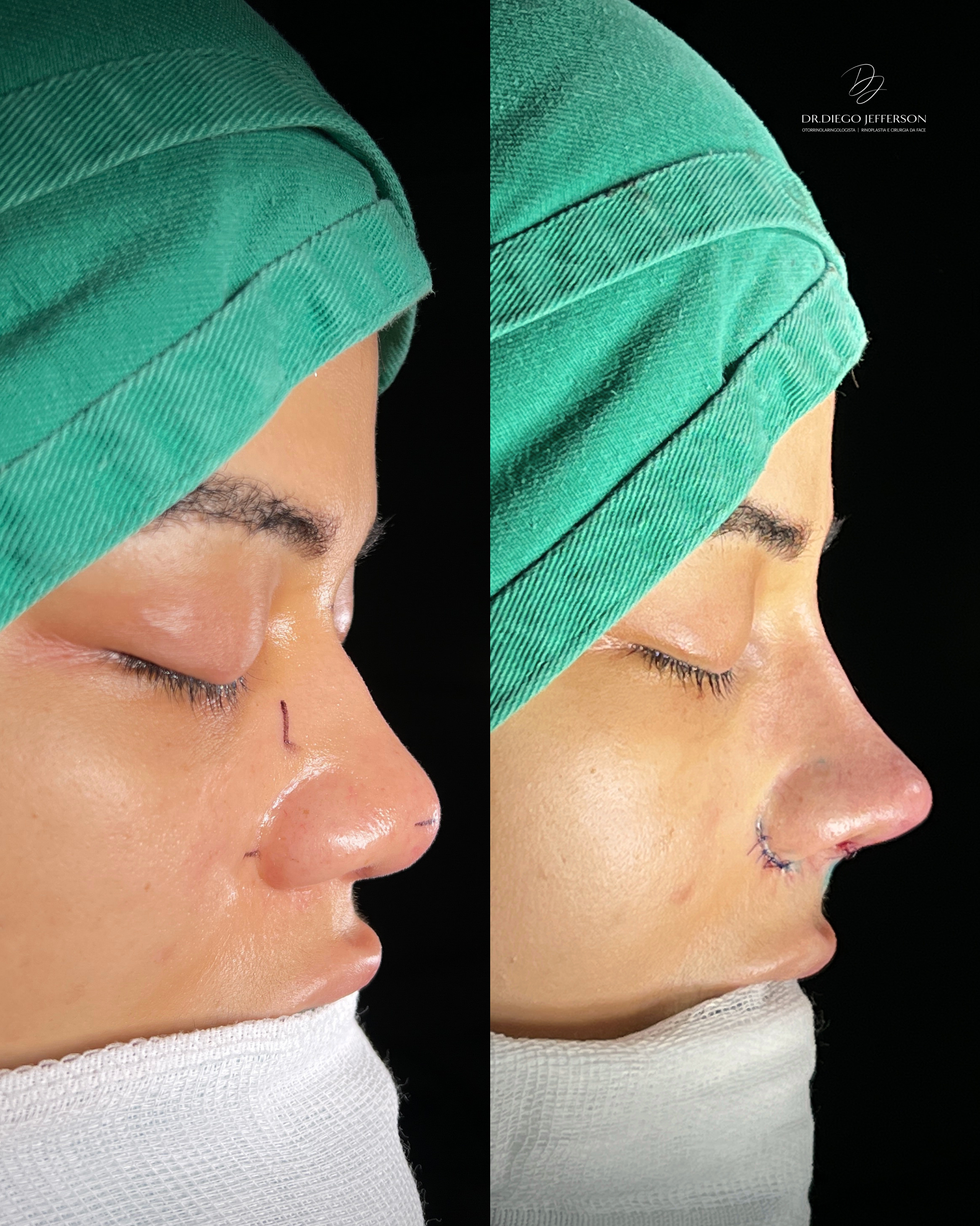 Comparativo antes e depois — caso clínico