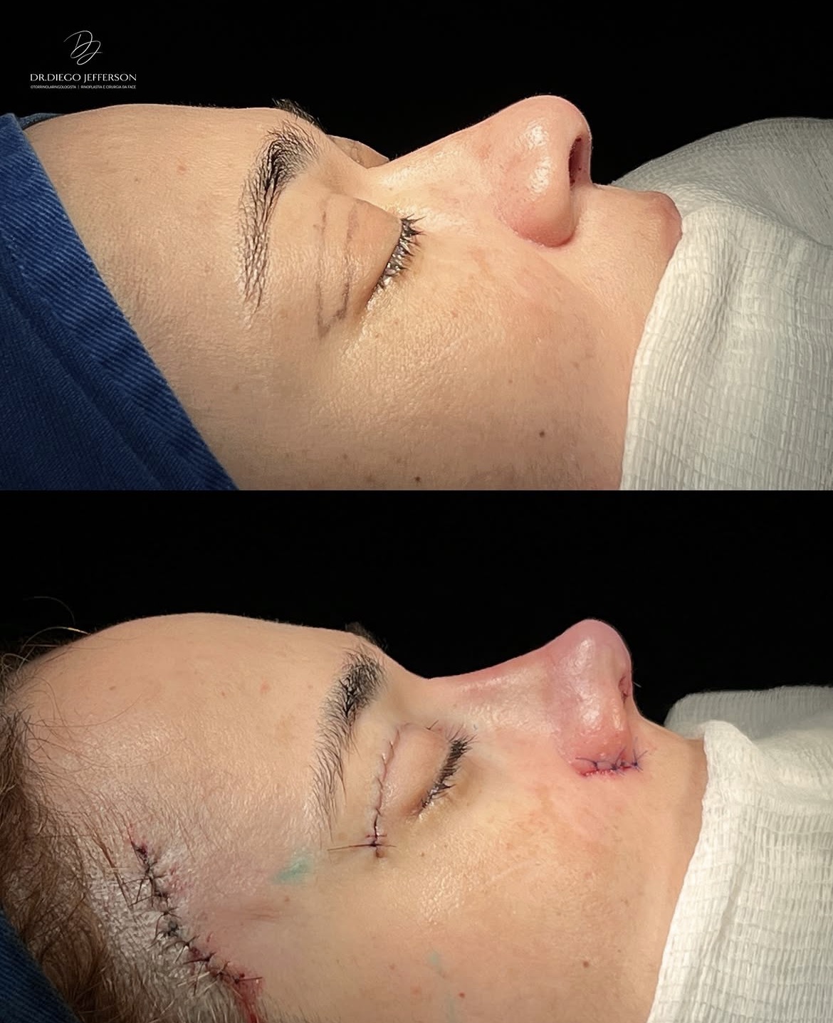 Comparativo antes e depois — caso clínico