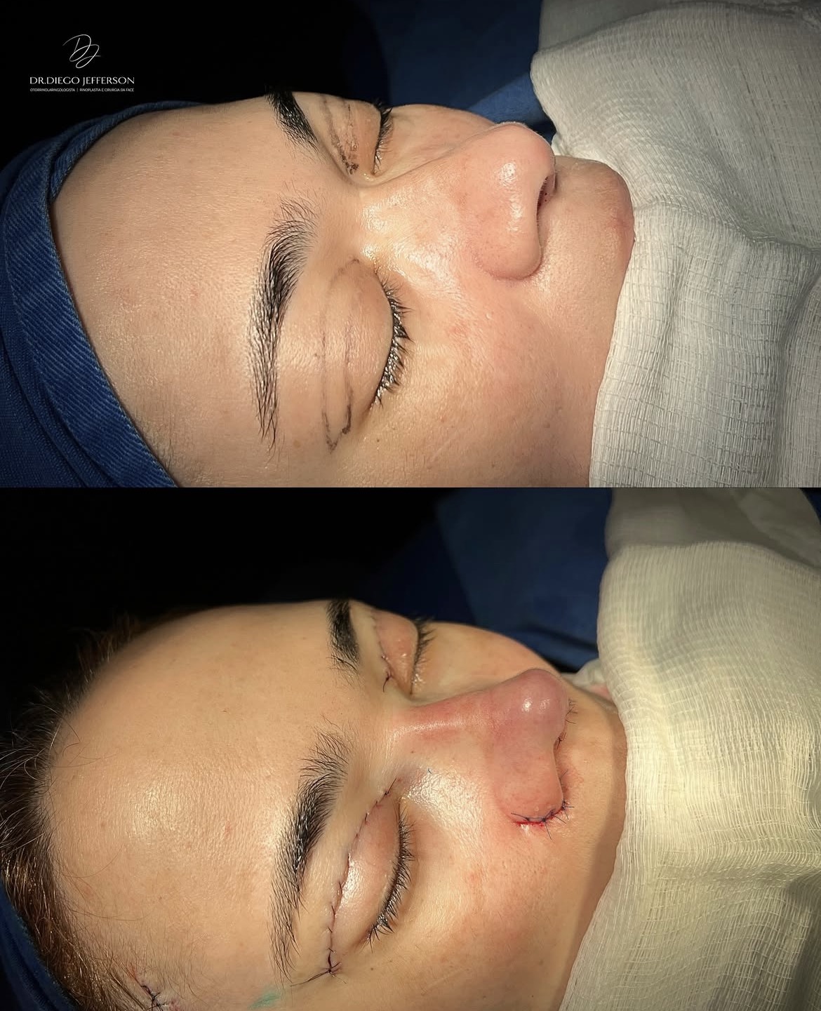 Comparativo antes e depois — caso clínico