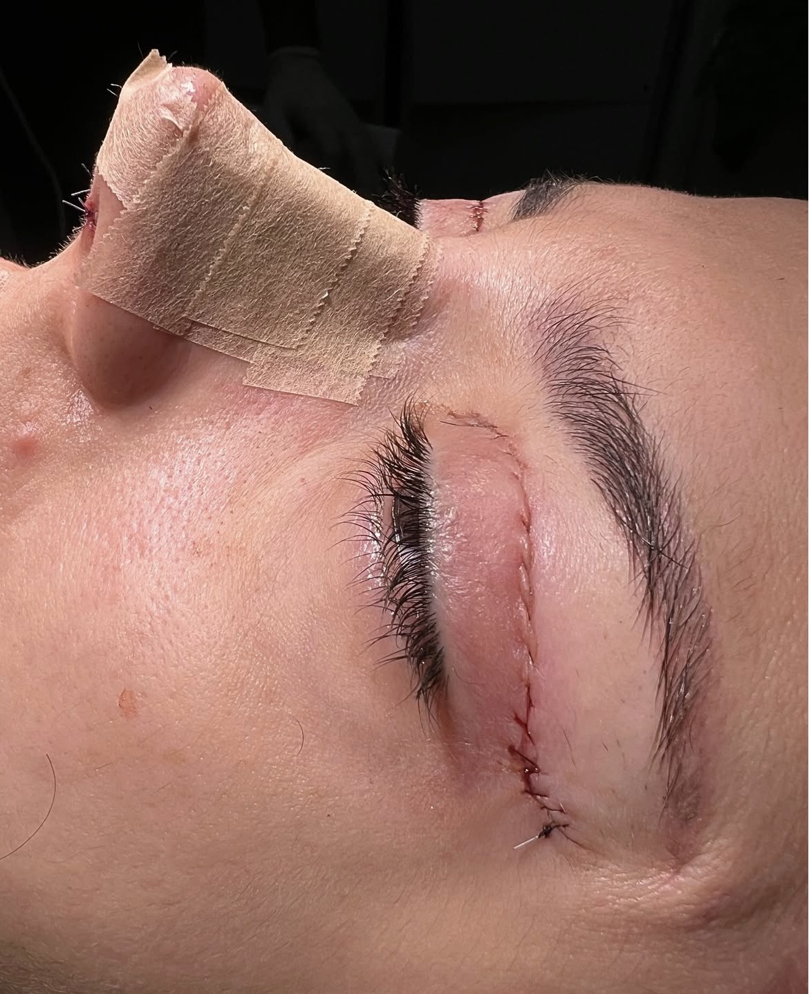 Comparativo antes e depois — caso clínico