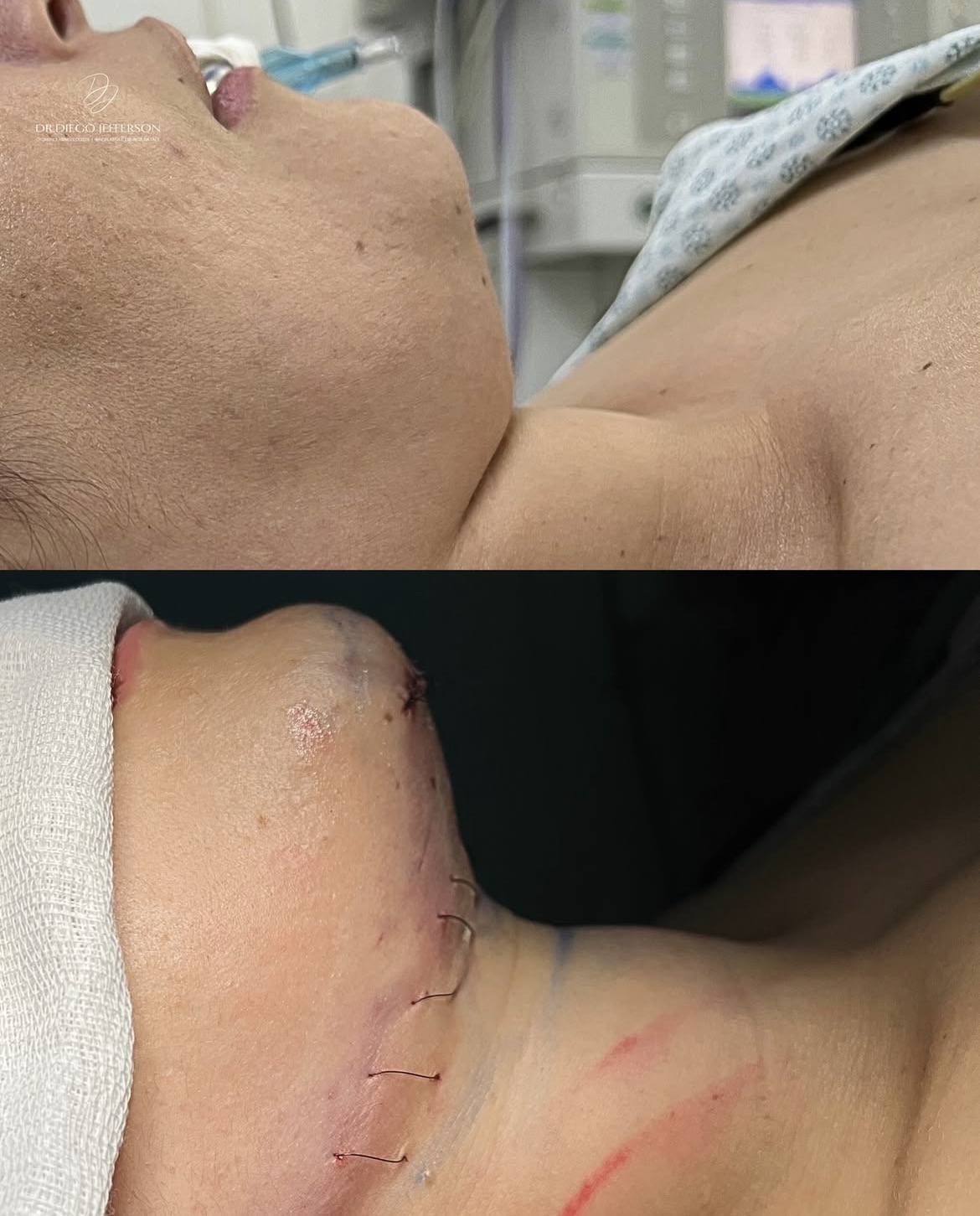 Comparativo antes e depois — caso clínico