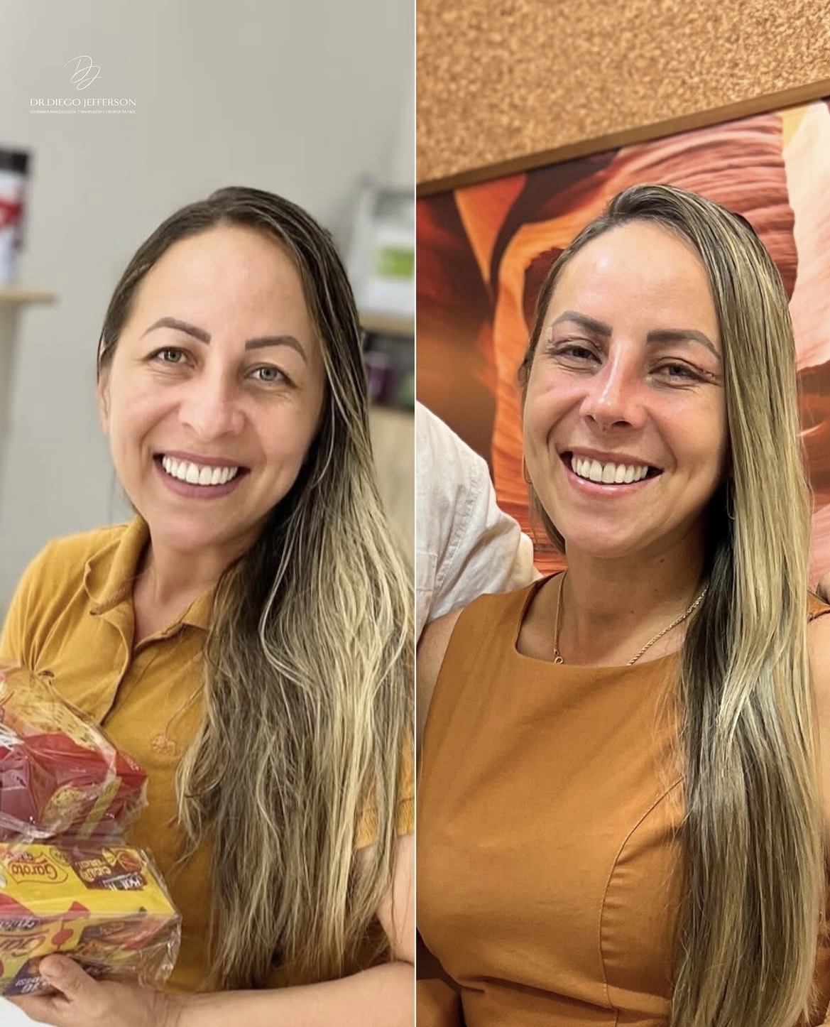 Resultado cicatrizado — paciente operado