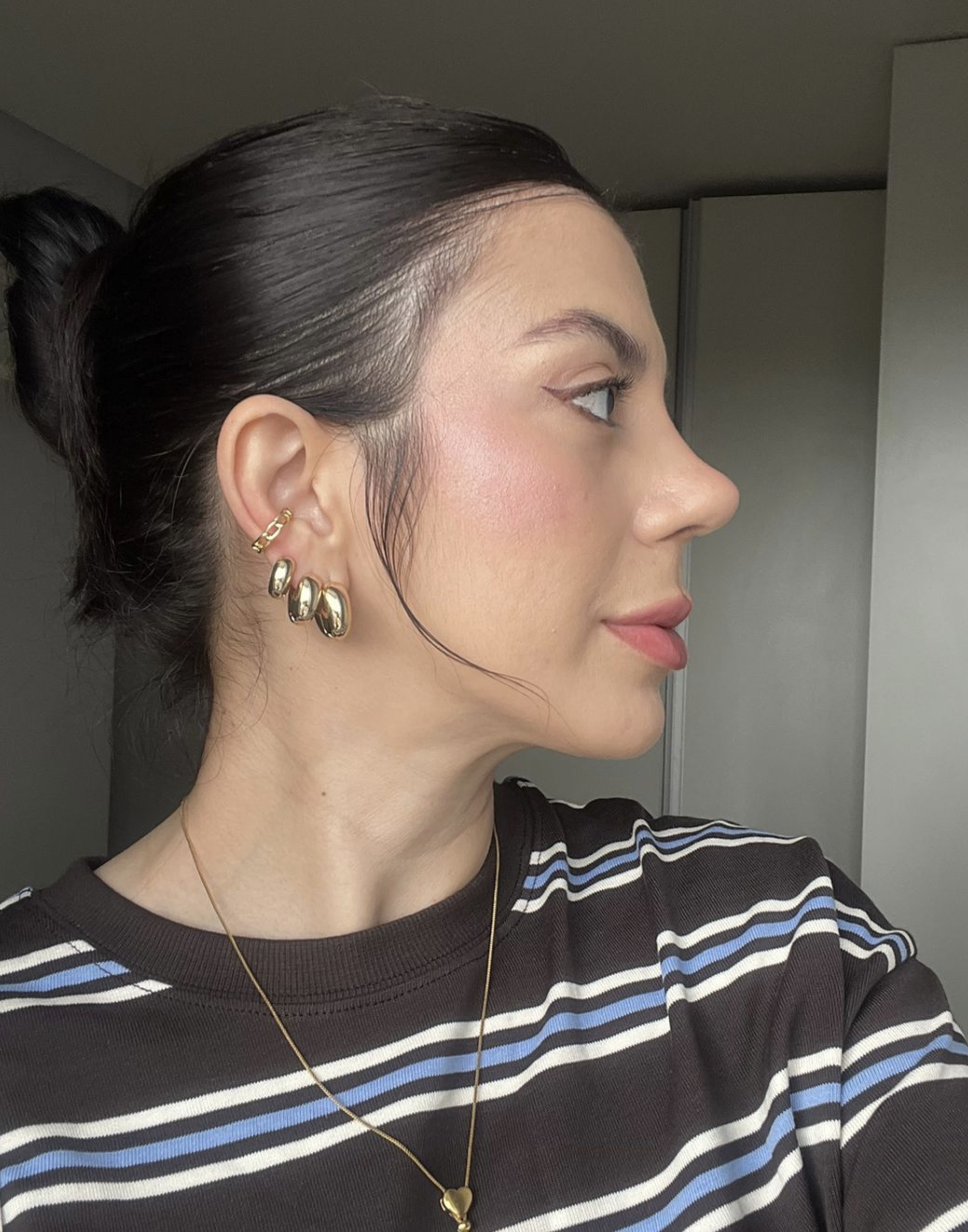 Resultado cicatrizado — paciente operado