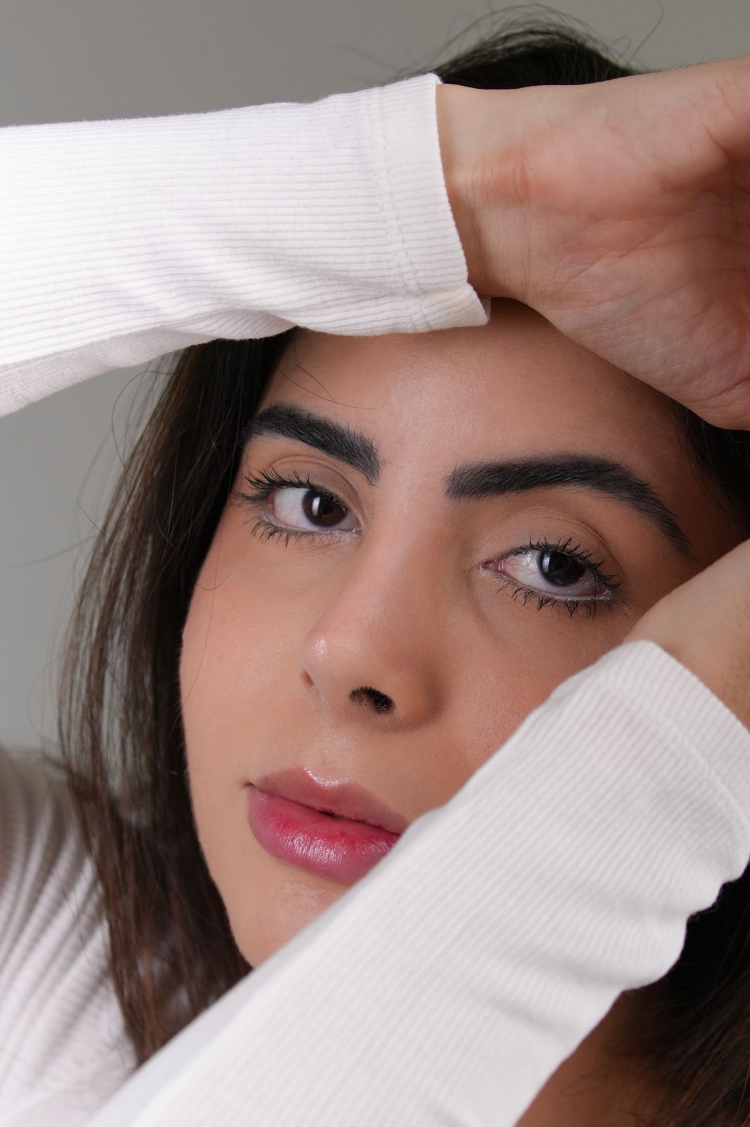 Resultado cicatrizado — paciente operado