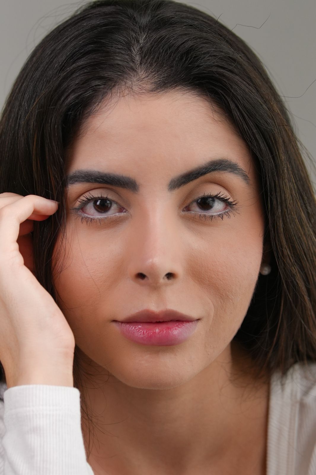 Resultado cicatrizado — paciente operado