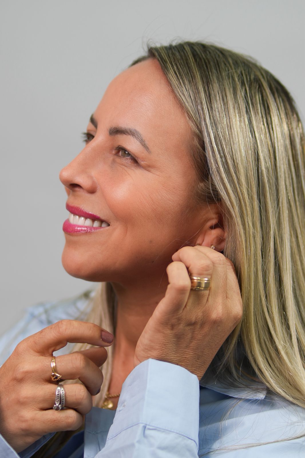 Resultado cicatrizado — paciente operado