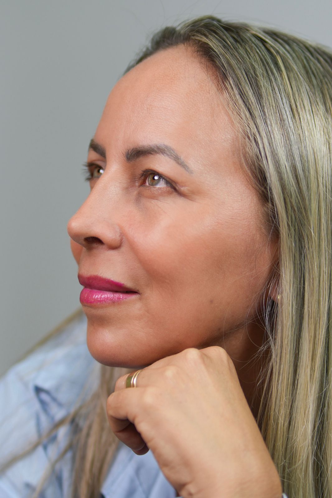 Resultado cicatrizado — paciente operado